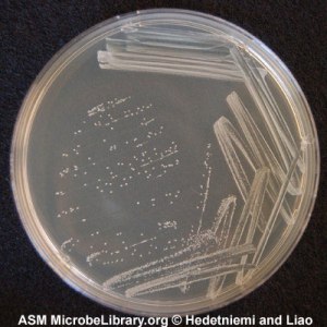 Crecimiento de Staphylococcus epidermidis en un agar nutritivo.