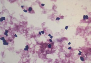 Staphylococcus epidermidis con tintinó Gram. 